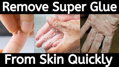 how to get wax strip glue off skin|how do i get sticky wax off my skin.